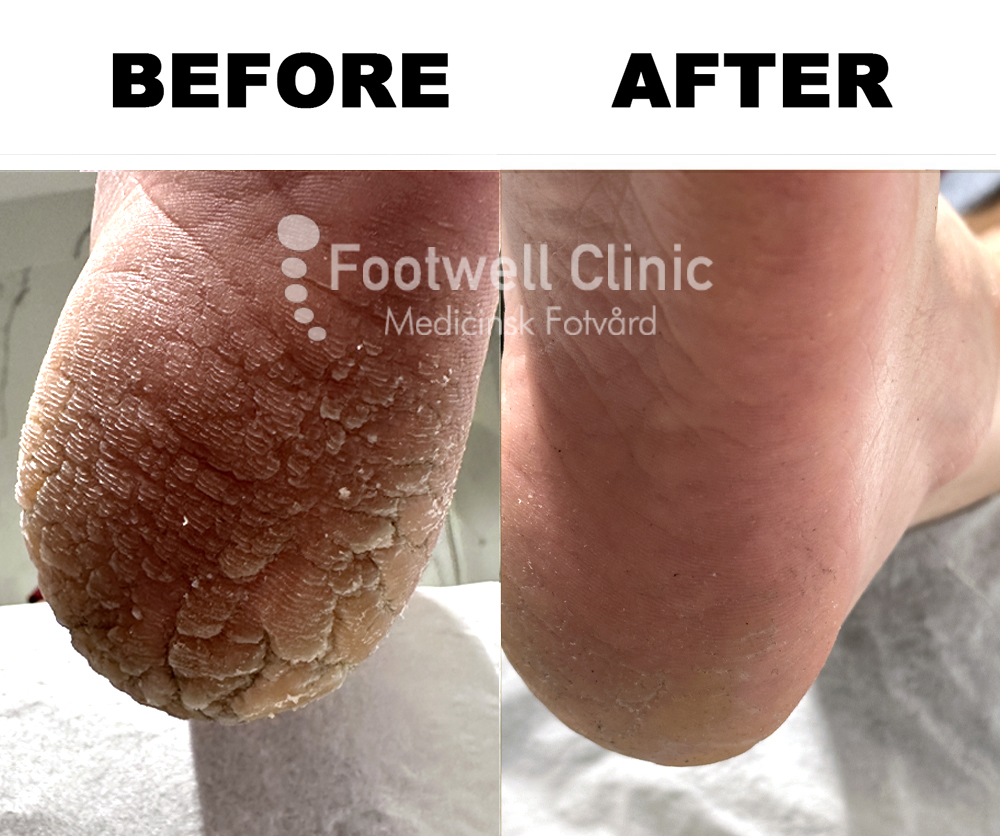 Behandling - före och efter