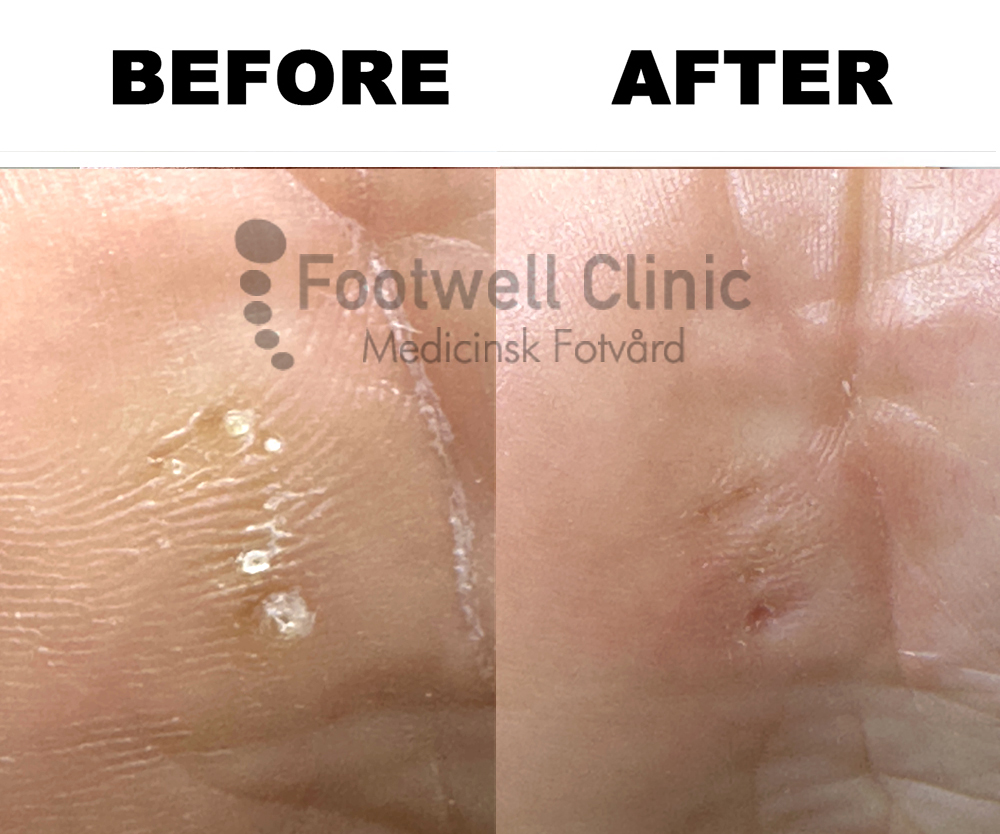 Behandling - före och efter