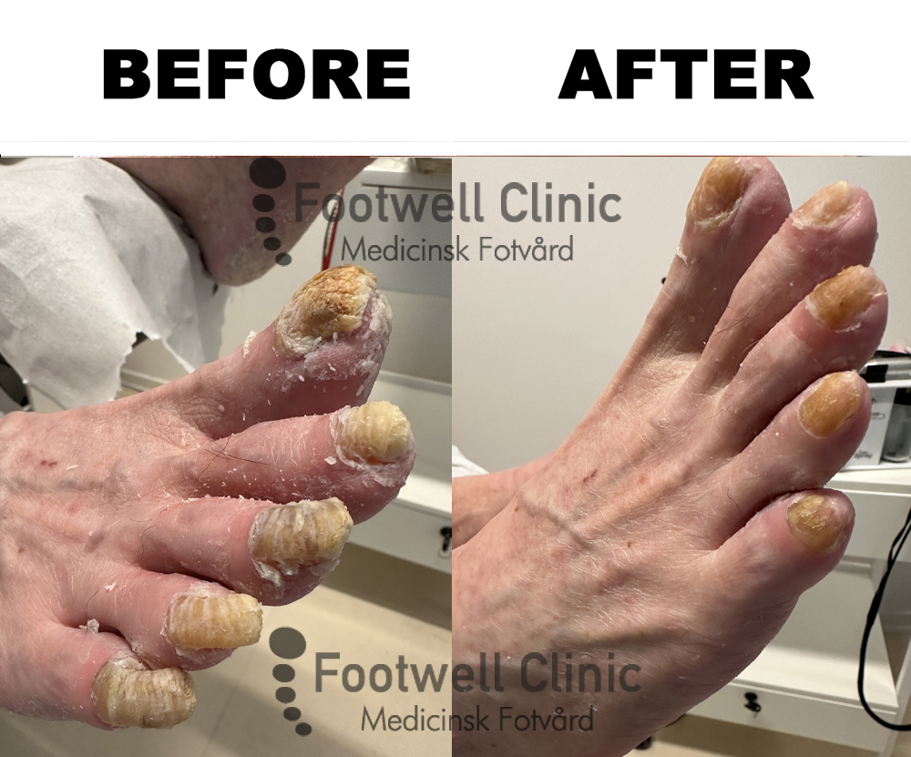 Behandling - före och efter