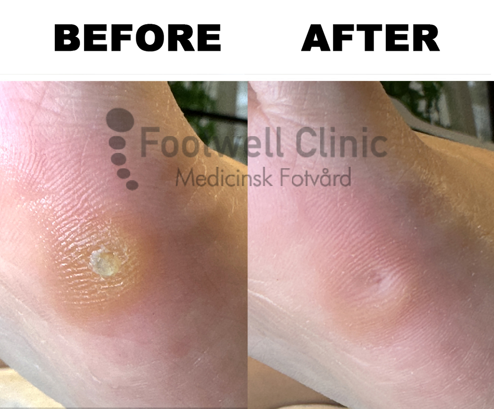 Behandling - före och efter  