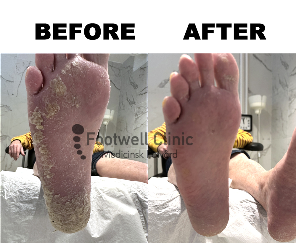 Behandling - före och efter