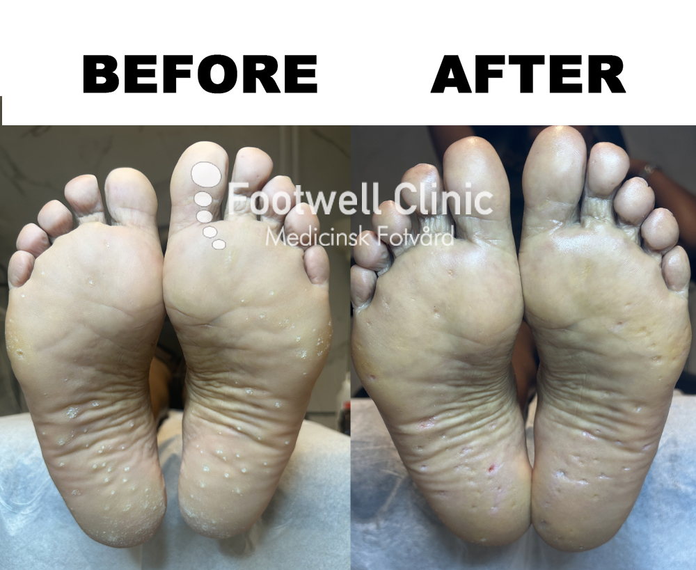 Behandling - före och efter  