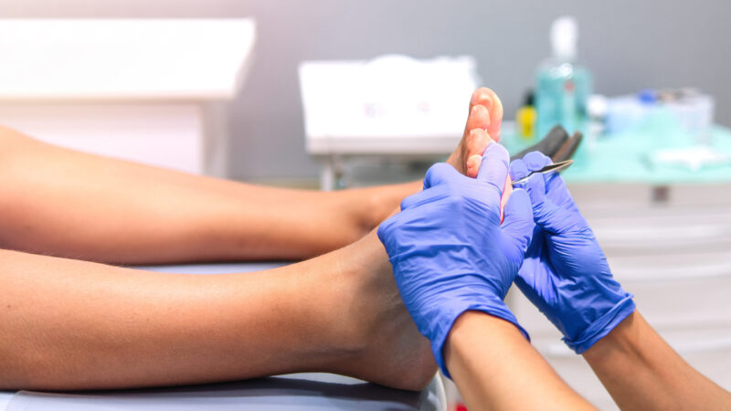 Medicinsk fotvård